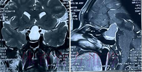 经核磁共振检查确认 塞巴略斯伤情没有预期严重